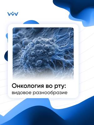 Неоплазия полости рта: опасность узелков и язв.